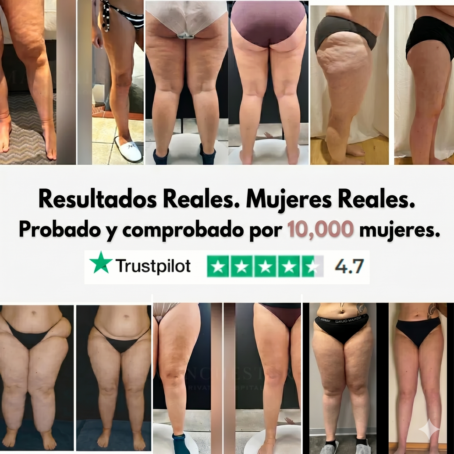 Clara Serra | Mallas 3D: alivié de forma natural el dolor y la hinchazón del lipedema